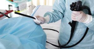 videoendoscopio