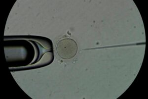 espermatozoides - ovulos