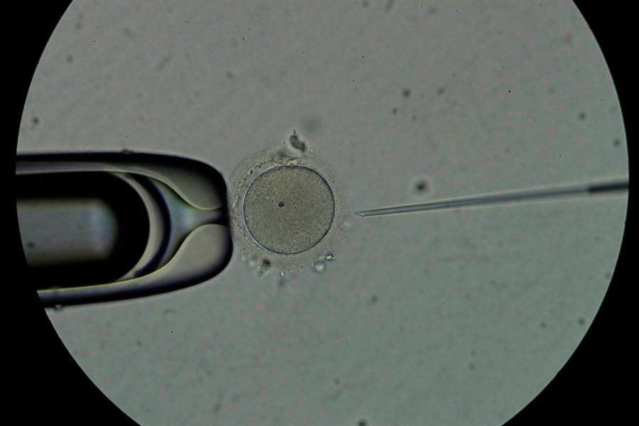 espermatozoides - ovulos
