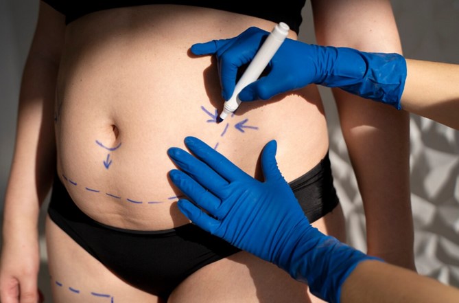 lipofilling.jpg