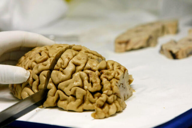 El Sumario - Estudio revela dónde reside el amor en el cerebro cerebro