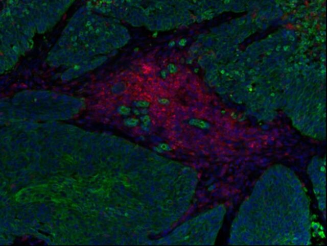 El Sumario - La eficacia de esta nueva inmunoterapia ha sido validada en modelos animales con un tipo de cáncer de pulmón inmunoterapia