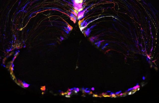 El Sumario - Descubren punto del cerebro donde se da el envejecimiento cerebro