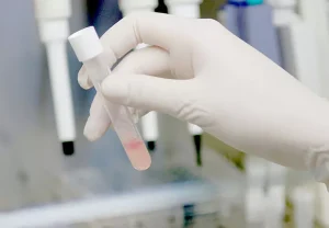 cancer-saliva-b.webp.webp.webp