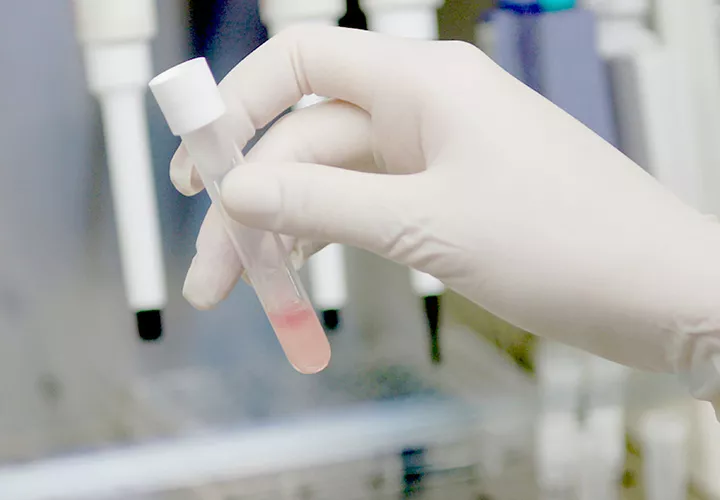 cancer-saliva-b.webp.webp.webp