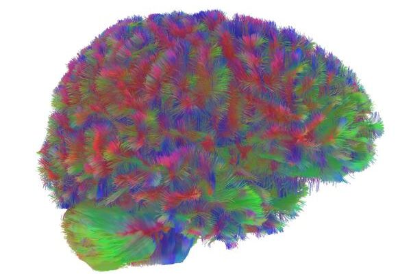 El cerebro pasa por 5 fases en la vida, que cambian a los 9, 32, 66 y 83 años